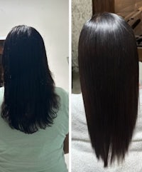 a woman's hair before and after a hair transplant